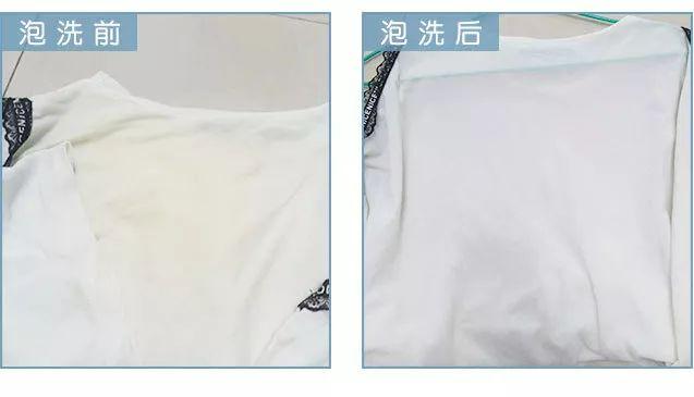 胸罩磨皮肤怎么办