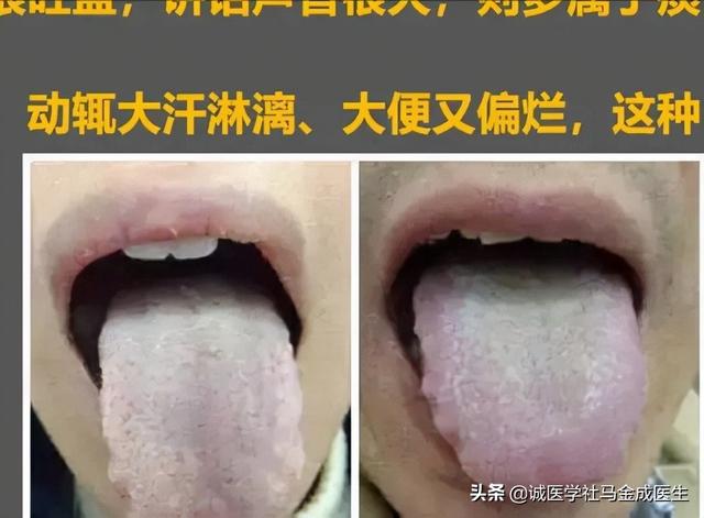 六种不同常见体质，看你属于哪种，看哪种方法适合你