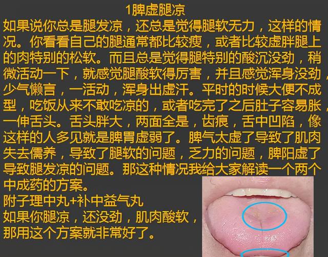 总是腿凉、腿寒？明白这三点，不用早早穿秋裤