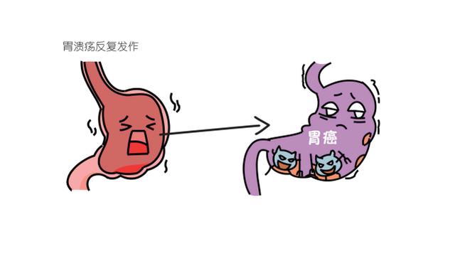 胃溃疡的图片动画图片