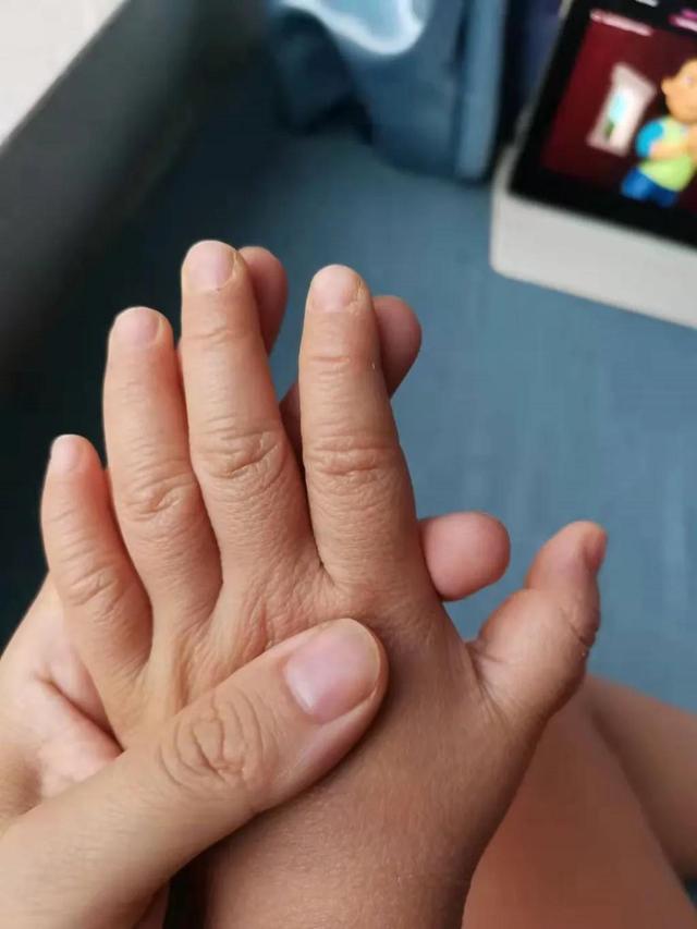 发热皮疹的孩子不少见，但这一例的诊断让人挠头