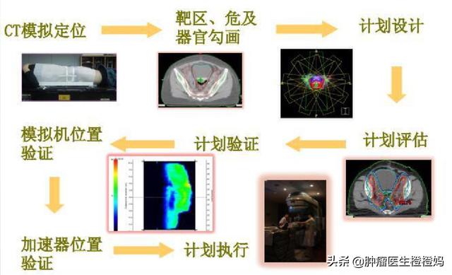 病人检查放疗是什么意思