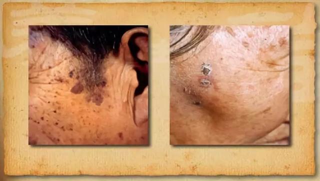 可对角化必可逆