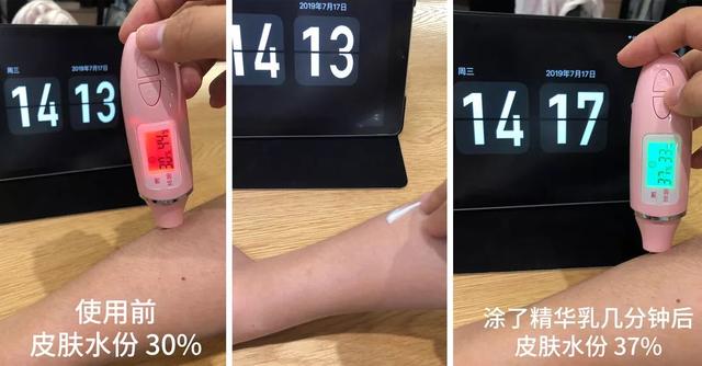 皮肤角化脱皮消银颗粒