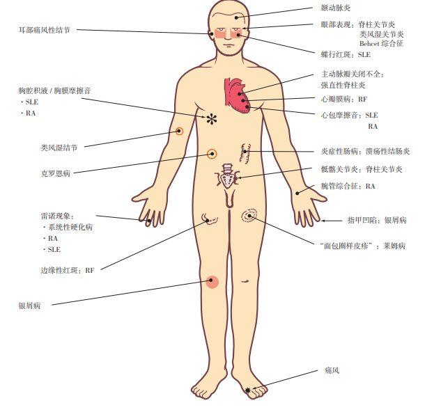 ena检查是什么意思