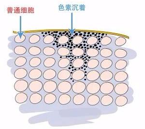 维a酸加入身体乳