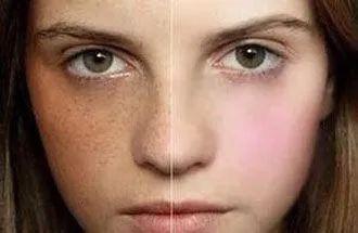 维a酸加入身体乳