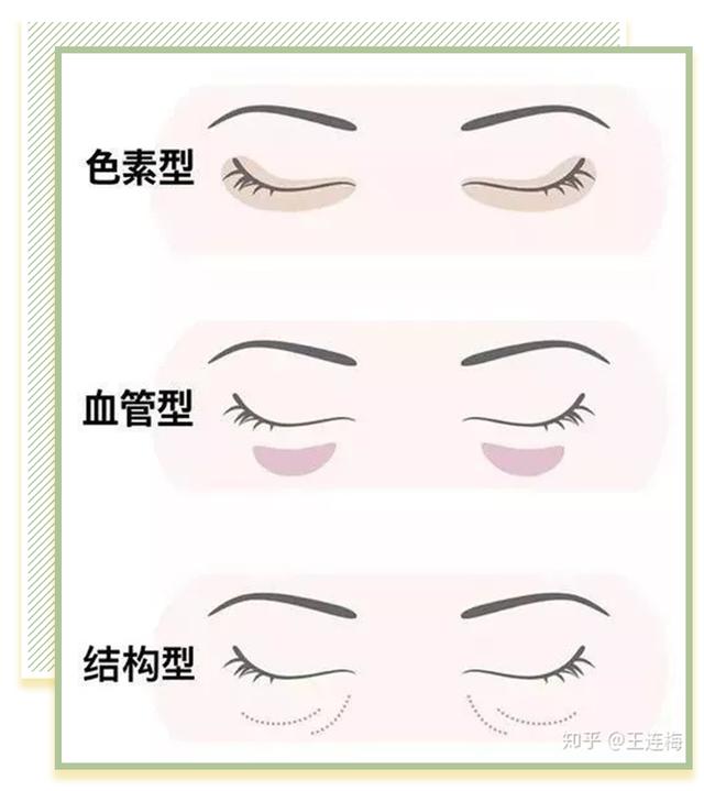 维a酸加入身体乳