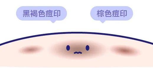 dr.wu杏仁酸精华身体乳