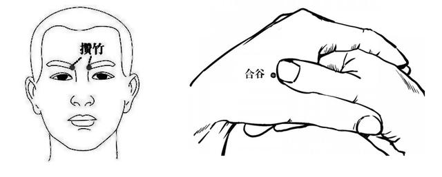 头痛莫慌张，妙手点穴帮您忙