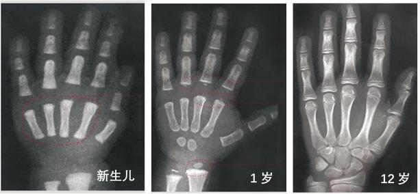 我家宝宝不长个怎么办？这几类检查了解一下