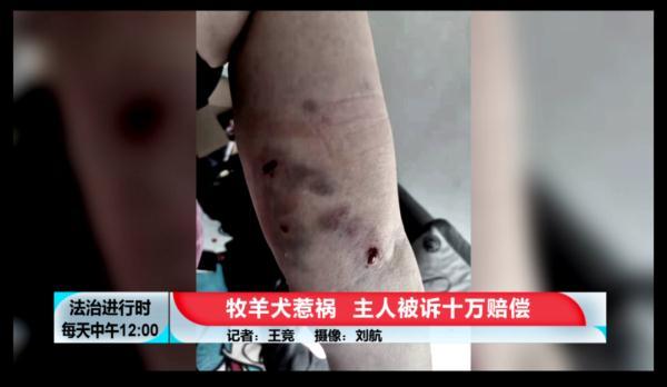 前段时间,杨女士在小区遛狗时,被一只大型烈犬攻击,导致身体被多处