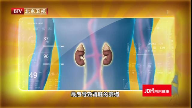 肾病不注意，警惕发展成尿毒症！3个中医古方调理肾脏，逆转肾病