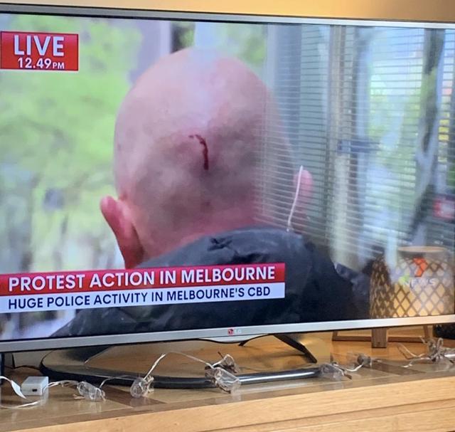 被锁脖、吐口水、泼尿……澳媒记者自称报道墨尔本抗议时受攻击