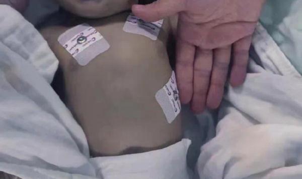 家长觉得奶粉“上火”用蔬菜水冲奶，孩子中毒还不自知！医生提醒