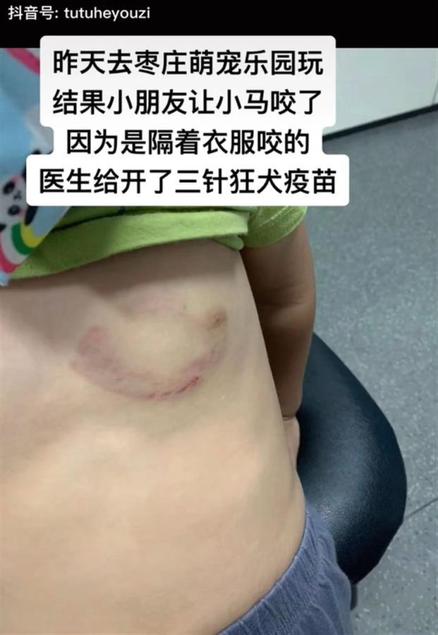 小马咬伤儿童后未予处置再次咬人？萌宠乐园：不是同一匹马