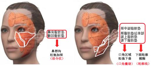 脸部松弛下垂怎么办