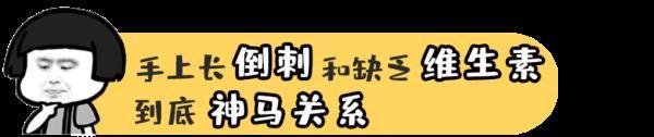 手上倒刺一直撕一直长，到底孩子缺了哪种维生素？