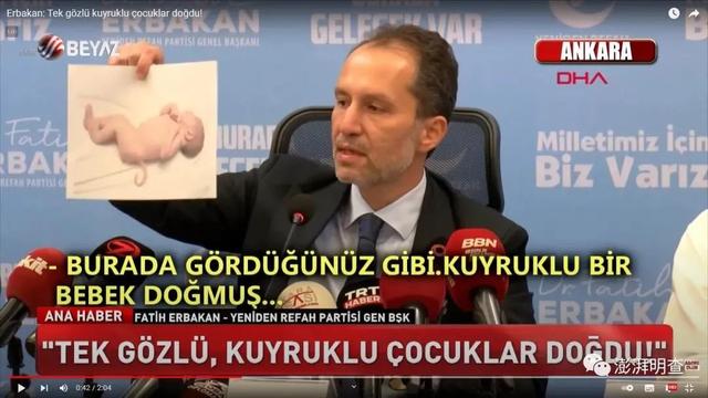 明查接种新冠疫苗后孕妇会生下长尾巴的畸形婴儿？