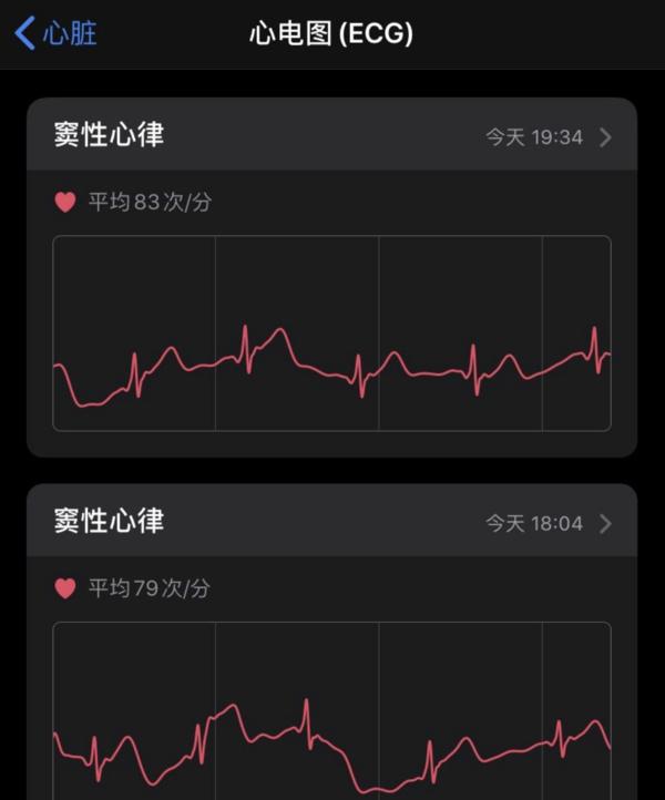 Apple  Watch  ECG  检测来啦，可检测“房颤”问题