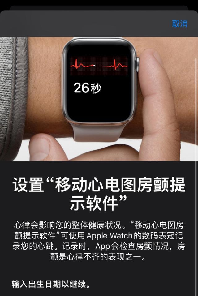 Apple  Watch  ECG  检测来啦，可检测“房颤”问题