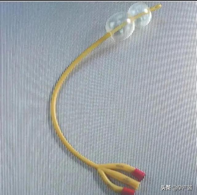 2017.12.12,17:39分8.1斤的儿子出生，瞬间觉得对得起江东父老了