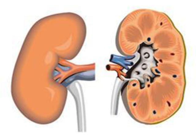 急性间质性肾炎,又称急性肾小管间质性肾炎,起病急,可由多种病因引起