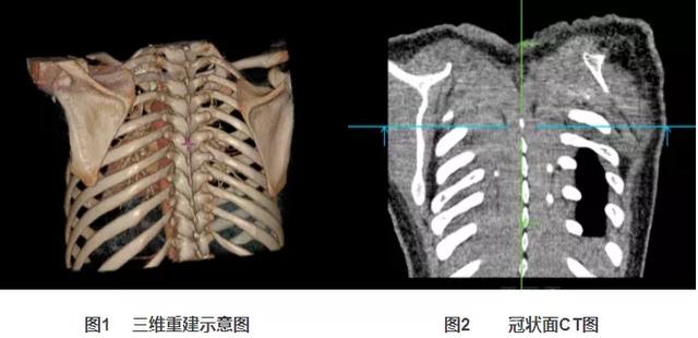 比起不靠谱的元宇宙，我更愿意期待另一个未来