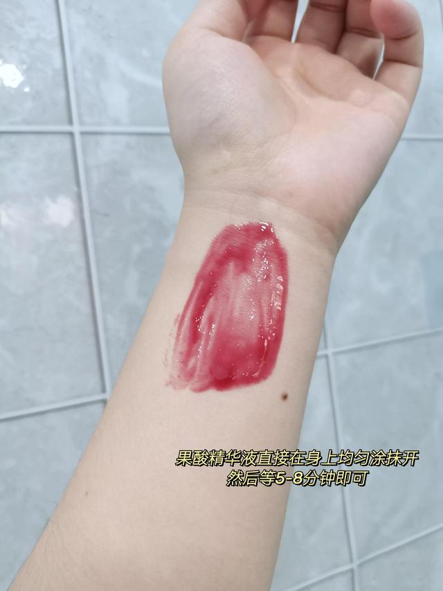 手臂鸡皮肤怎么刷酸