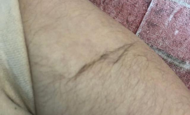 使用身体乳会长汗毛吗