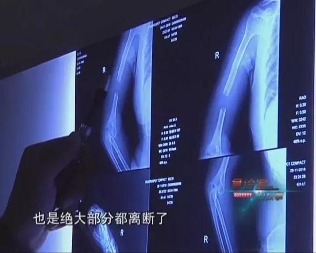 昭通矿山破碎机洗砂机