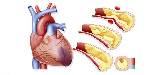 它从6方面，多靶点改善冠心病心绞痛、心衰、心梗，促进心脏康复