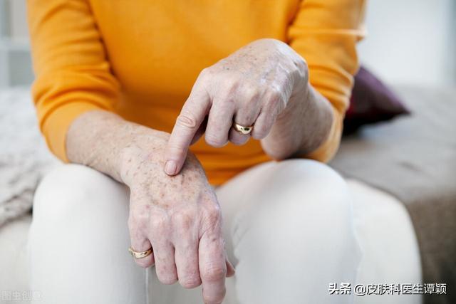 脂溢性角化手术费用