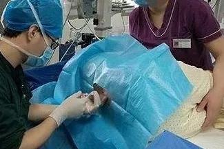 聊聊剖腹产那些事儿（一）