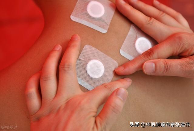 三伏貼并非是萬能貼，專家提醒：這類人一定要謹慎使用