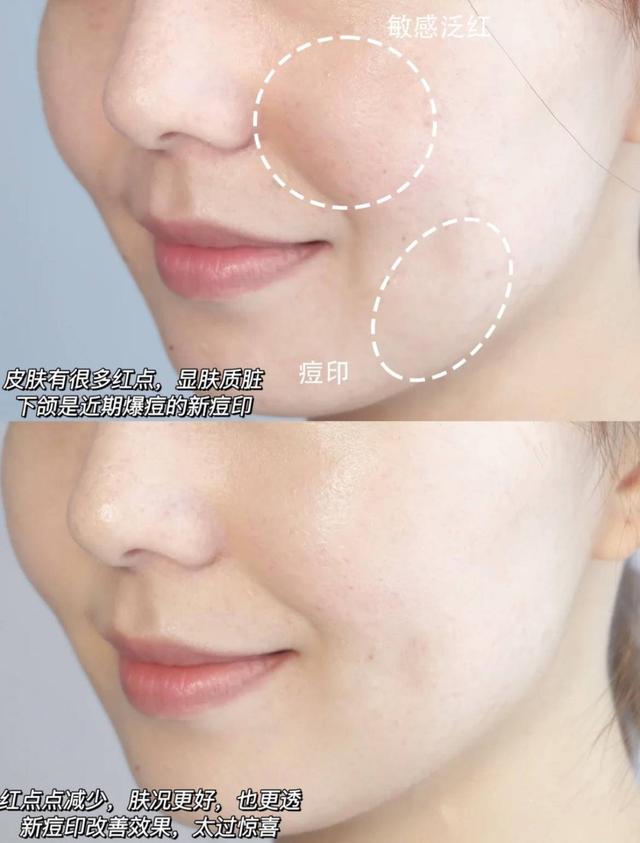 雏菊的天空身体乳祛痘