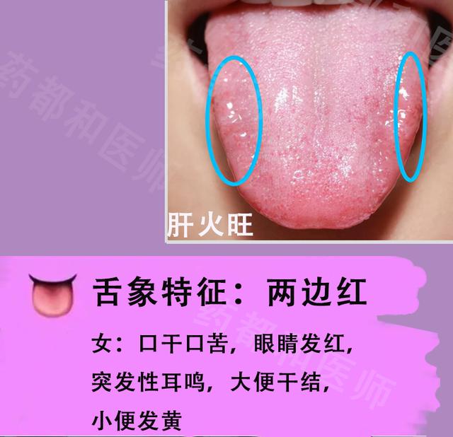 胆囊息肉伴有胆结石胆囊有结石和息肉临床表现