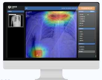 天医云智慧医疗再发力，人工智能精准赋能医学影像
