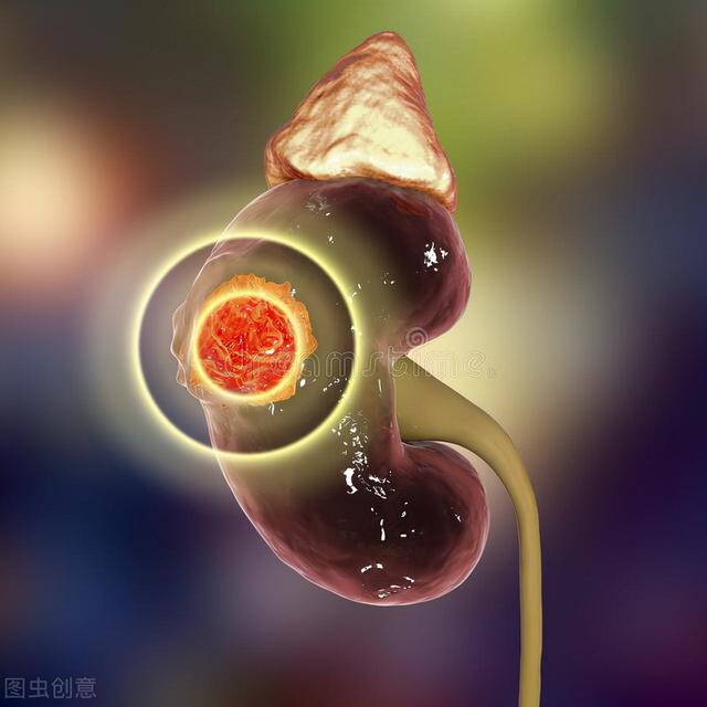 肾功能衰退后，如何排出多余毒素？2个饮食疗法排毒护肾显著