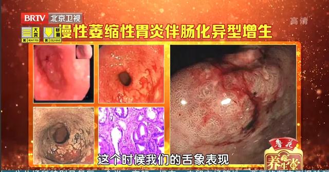 玳玳花
