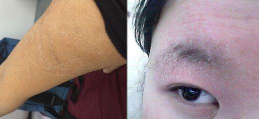 手工皂洗鸡皮肤