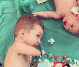 B超婴儿无四肢，18岁妈妈拒绝堕胎，冒险生子，把孩子养成男子汉