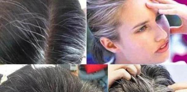 少头白，年轻如何对抗白发？