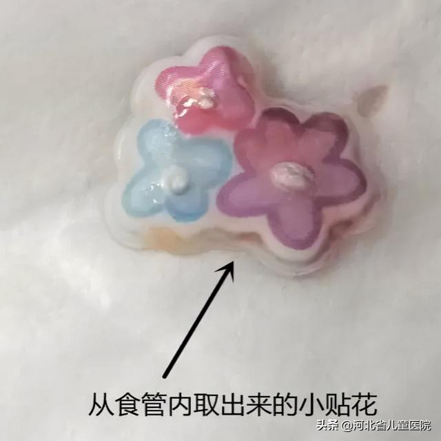 省儿童医院的紧急通知，一月内3例！警惕隐形“食管异物”