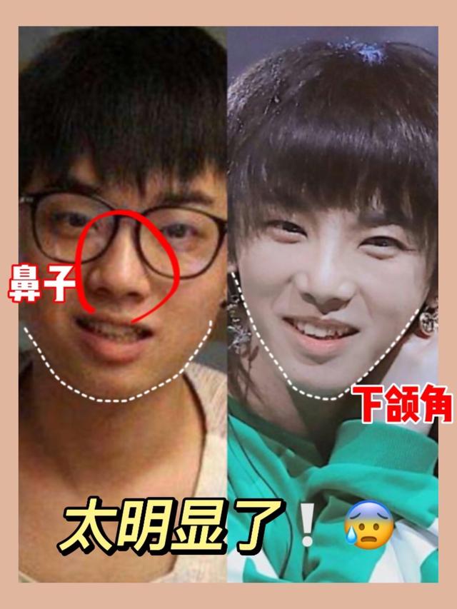 侣皓喆:男明星也有容貌焦虑？有人为了美进了整容院，有人选择了减肥