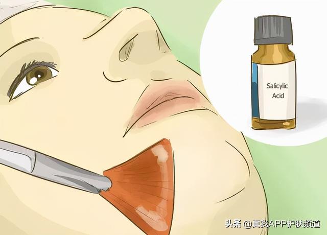 角化过度和角化不良