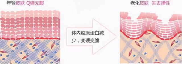 表皮中角化细胞为什么不透水