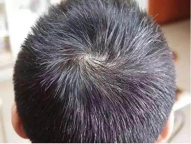 六味地黄丸是什么来历？女人能吃吗？糖尿病能吃吗？别选错了