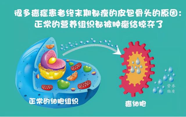 癌症患者最怕遇到“恶液质”，为什么？应该如何有效防治呢？