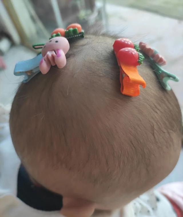 宝宝不吃饭日渐消瘦可能是疳积，欧阳医生教你辨别孩子是否有疳积